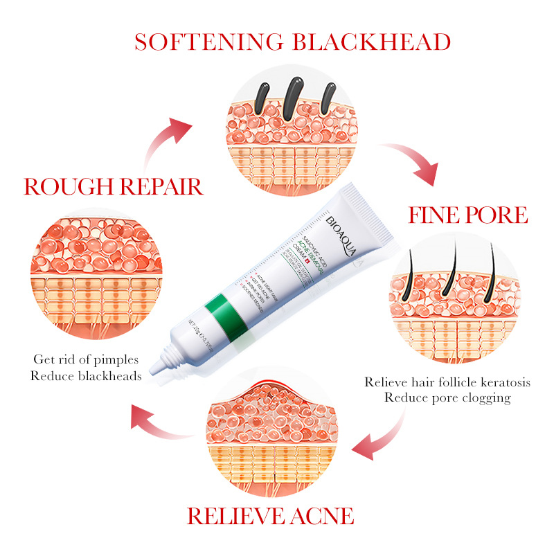 1/2/3pcs BIOAQUA Salicylic Aci - Salicylic Acid Blackhead Remover ulasan dan harga