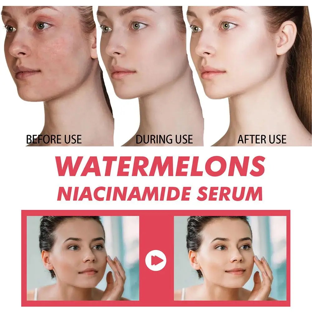 Watermelon Glow Niacinamide Mo - Hyaluronic Acid Facial Serum ulasan dan harga