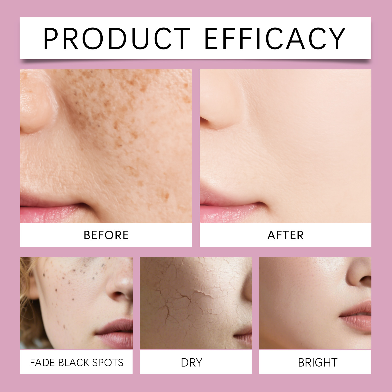 Korean Calcium Collagen Skinca - Hyaluronic Acid Facial Serum ulasan dan harga