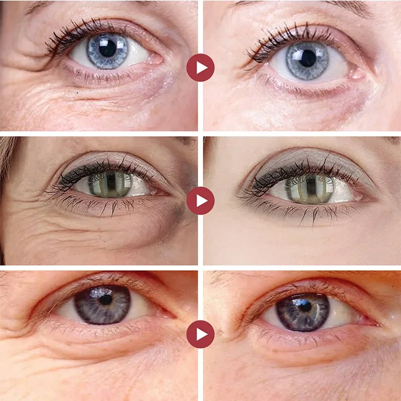 Wrinkle Remove Eyes Patches Fi - Collagen Under Eye Patches ulasan dan harga